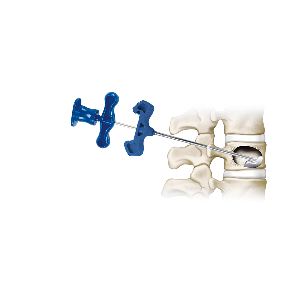 Kyphoplasty Balloon system